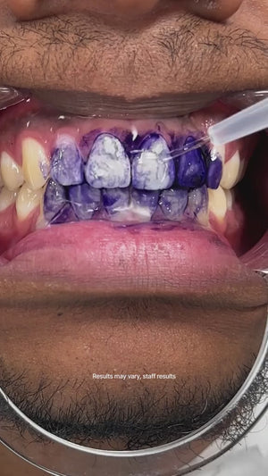 Hismile V34 Teeth Brightening Serum